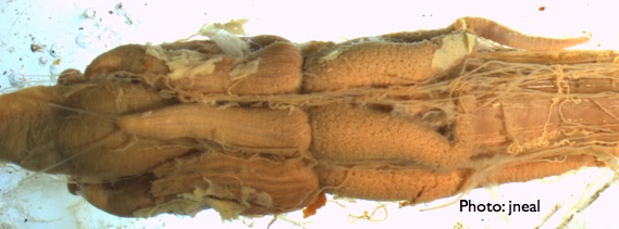 Grasshopper Digestive System